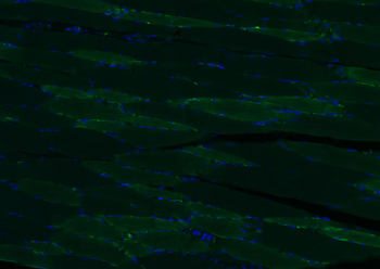 Calreticulin Rabbit Polyclonal Antibody
