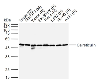 Calreticulin Rabbit Polyclonal Antibody