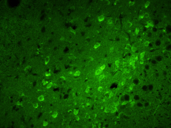 Calreticulin Rabbit Polyclonal Antibody