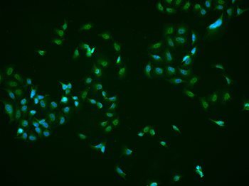 SET Rabbit Polyclonal Antibody