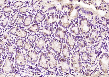 CDCA7L Rabbit Polyclonal Antibody