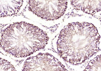 CDCA7L Rabbit Polyclonal Antibody