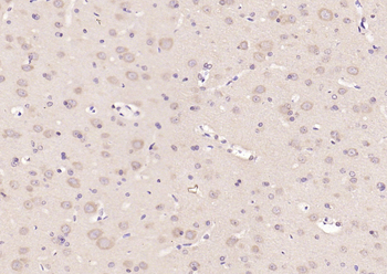 14-3-3 Rabbit Polyclonal Antibody