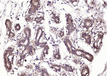 RIL Rabbit Polyclonal Antibody