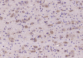 RAB11A Rabbit Polyclonal Antibody