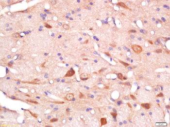 RAB11A Rabbit Polyclonal Antibody