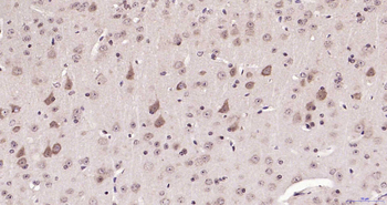 SMYD2 Rabbit Polyclonal Antibody