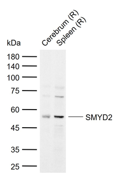SMYD2 Rabbit Polyclonal Antibody