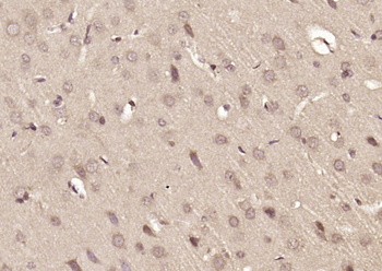 ASB10 Rabbit Polyclonal Antibody