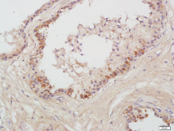 Prostatic Acid Phosphatase Rabbit Polyclonal Antibody