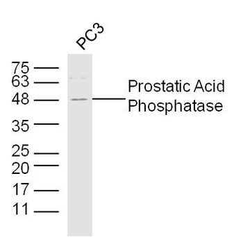 Prostatic Acid Phosphatase Rabbit Polyclonal Antibody
