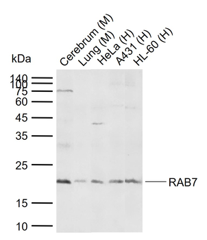 RAB7A Rabbit Polyclonal Antibody
