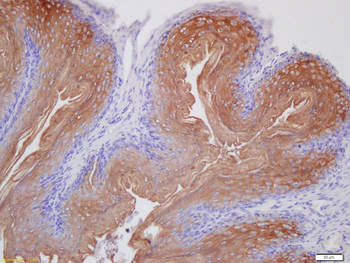 Laminin 5 Rabbit Polyclonal Antibody