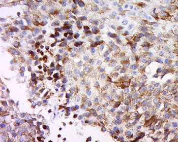 MAGEB3 Rabbit Polyclonal Antibody