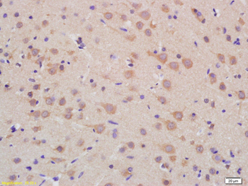 PMPCB Rabbit Polyclonal Antibody