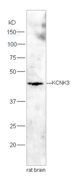 KCNK3 Rabbit Polyclonal Antibody