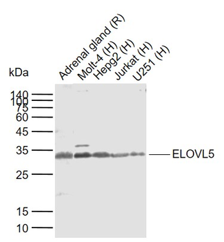ELOVL5 Rabbit Polyclonal Antibody