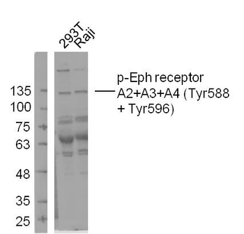 Phospho-Eph receptor A2+A3+A4 (Tyr588 + Tyr596) Rabbit Polyclonal Antibody