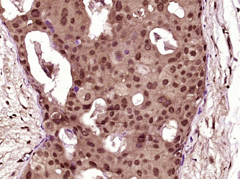 RRAS Rabbit Polyclonal Antibody