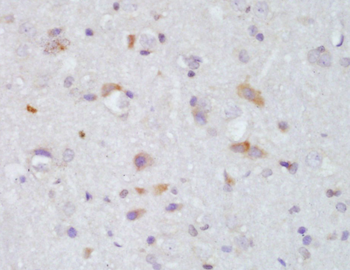 CAT Rabbit Polyclonal Antibody