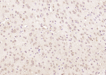 Ankyrin-1 Rabbit Polyclonal Antibody