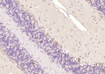 Ankyrin-1 Rabbit Polyclonal Antibody