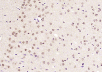 NUSAP1 Rabbit Polyclonal Antibody
