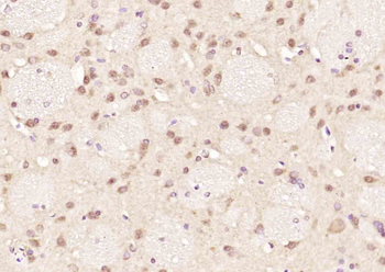 PSF2 Rabbit Polyclonal Antibody