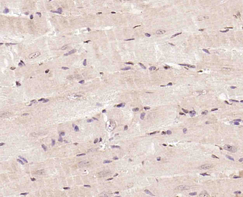 CABLES2 Rabbit Polyclonal Antibody