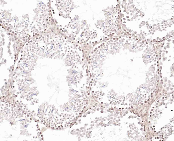 CABLES2 Rabbit Polyclonal Antibody