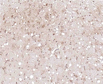 CABLES2 Rabbit Polyclonal Antibody