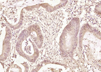 IMPDH2 Rabbit Polyclonal Antibody