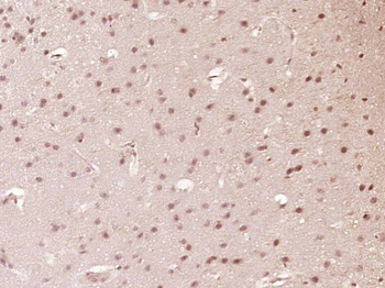 SETBP1 Rabbit Polyclonal Antibody