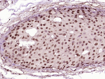 SMYD3 Rabbit Polyclonal Antibody