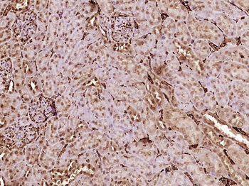 BCSC1 Rabbit Polyclonal Antibody