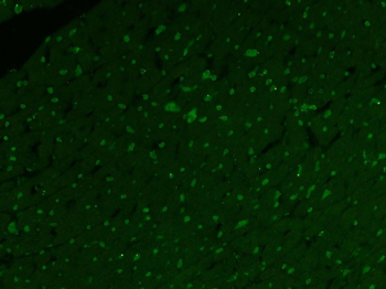 BCSC1 Rabbit Polyclonal Antibody