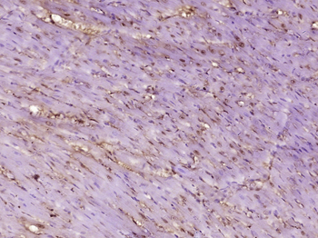 BCSC1 Rabbit Polyclonal Antibody