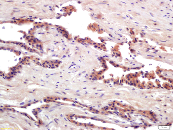 PRSS8 Rabbit Polyclonal Antibody