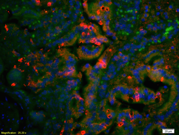 AT2R Rabbit Polyclonal Antibody