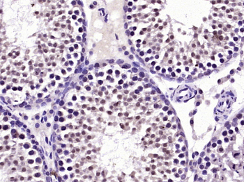 TKTL1 Rabbit Polyclonal Antibody