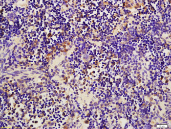 Beta 2 Microglobulin Rabbit Polyclonal Antibody