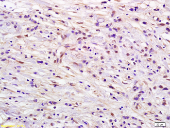 DUT Rabbit Polyclonal Antibody