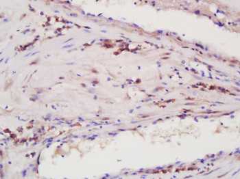 ANGPTL2 Rabbit Polyclonal Antibody
