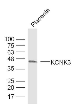 KCNK3 Rabbit Polyclonal Antibody