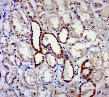 MAGEB4 Rabbit Polyclonal Antibody