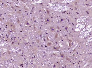 Drebrin Rabbit Polyclonal Antibody
