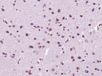 Drebrin Rabbit Polyclonal Antibody