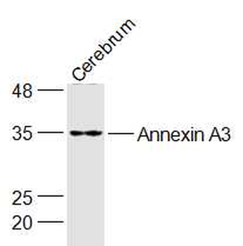 Annexin A3 Rabbit Polyclonal Antibody