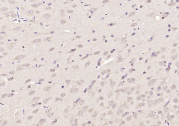 LRDD Rabbit Polyclonal Antibody