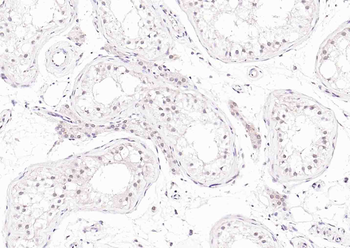 RANBP9 Rabbit Polyclonal Antibody